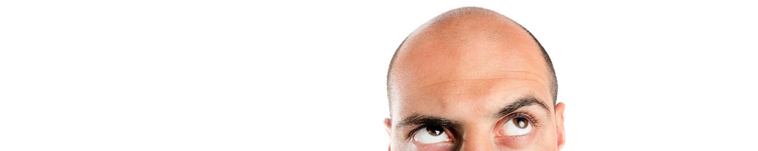 Financing Hair Loss Restoration Procedures